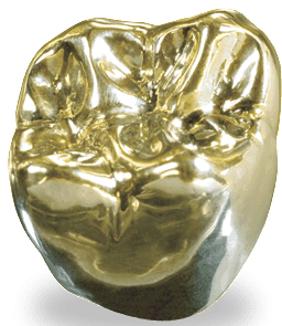 Dental gold